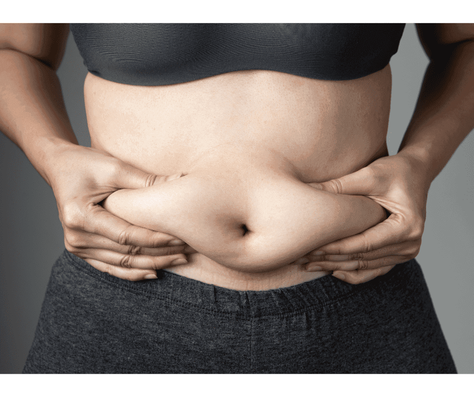 שומן תת עורי